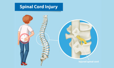 Spinal Cord Injuries