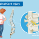 Spinal Cord Injuries