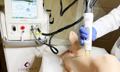 Electrolysis Hair Removal