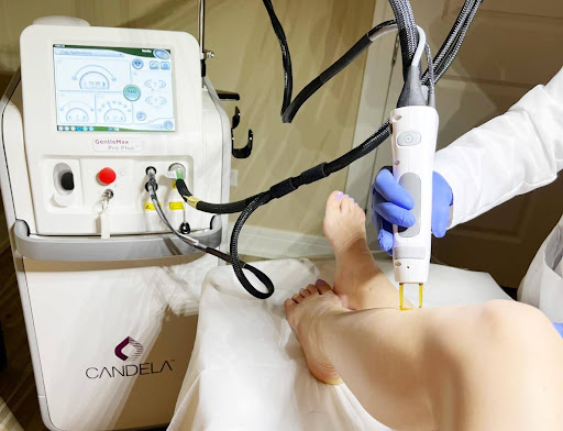 Electrolysis Hair Removal