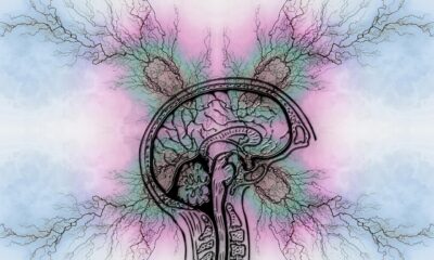 DoctorHub360.com Neurological Diseases